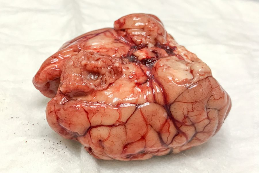 brain-1