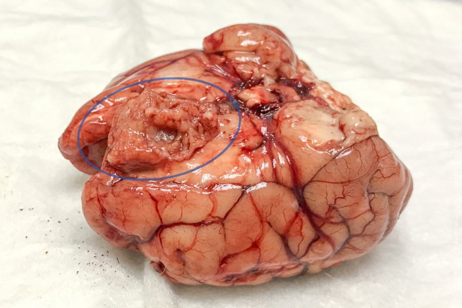 brain-2